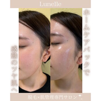 新メニュー「メルティングマスク」のご案内